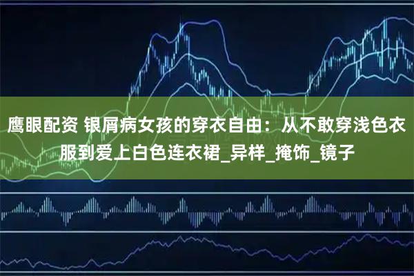 鹰眼配资 银屑病女孩的穿衣自由：从不敢穿浅色衣服到爱上白色连衣裙_异样_掩饰_镜子